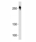 Western blot analysis of lysate from U-87 MG cell line using ROS1 antibody at 1:1000.