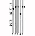 Western blot testing of Beclin antibody and (1) A2058, (2) HeLa, (3) mouse brain, (4) Y79, and (5) HL-60 lysate