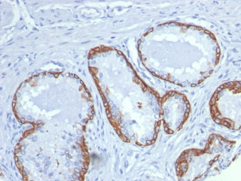 IHC staining of FFPE human prostate tissue with Keratin 14 antibody (clone KRT14/8260R). HIER: boil tissue sections in pH 9 10mM Tris with 1mM EDTA for 20 min and allow to cool before testing.