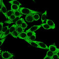 Immunofluorescent staining of PFA-fixed human HeLa cells with CCR5 antibody (clone 12D1).
