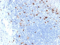 IHC testing of FFPE human tonsil with CD103 antibody (clone ITGAE/2063). HIER: boil tissue sections in pH6, 10mM citrate buffer, for 10-20 min followed by cooling at RT for 20 min.