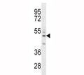 CD14 antibody western blot analysis in A549 lysate. Predicted size 40-55 kDa depending on glycosylation level