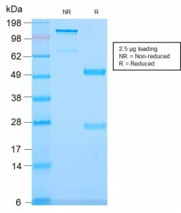 SDS-PAGE analysis of purified, BSA-free CD79b antibody (clone IGB/2940R) as confirmation of integrity and purity.