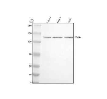 Western blot analysis of EPHA4 using anti-EPHA4 antibody. Electrophoresis was performed on a 8% SDS-PAGE gel at 80V (Stacking gel) / 120V (Resolving gel) for 2 hours. Lane 1: human Caco-2 whole cell lysates, Lane 2: human MCF-7 whole cell lysates, Lane 3: human SIHA whole cell lysates. After electrophoresis, proteins were transferred to a nitrocellulose membrane at 150 mA for 50-90 min. Blocked the membrane with 5% non-fat milk/TBS for 1.5 hour at RT.