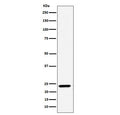 Western blot testing of human A549 cell lysate with DNAJC12 antibody. Predicted molecular weight ~23 kDa.