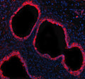 Immunofluorescent staining of GCNT2 using anti-GCNT2 antibody (green) and anti-Beta Tubulin antibody (red). GCNT2 was detected in an immunocytochemical section of human A549 cells. Enzyme antigen retrieval was performed using IHC enzyme antigen retrieval reagent for 15 mins. The cells were blocked with 10% goat serum. And then incubated with 5 ug/ml rabbit anti-GCNT2 antibody and mouse anti-Beta Tubulin antibody overnight at 4oC.