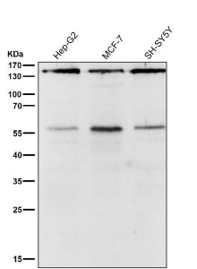 Western blot testing of human samples using the ROCK1 antibody at 1:2000 dilution for 1 hour at room temperature. A predominant band is detected at an approximately 158 kDa in all samples, consistent with full length ROCK1. An additional weaker band is observed just above the 55 kDa marker, which likely represents a proteolytic fragment of ROCK1 generated during cell stress or sample preparation rather than a distinct isoform.