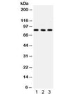 Western blot testing of 1) rat PC-12, 2) mouse HEPA and 3) human HeLa lysate with SP3 antibody. Predicted/observed molecular weight ~82 kDa.