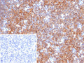 IHC staining of FFPE human tonsil tissue with BCL-6 corepressor antibody (clone BCOR/2372). Inset: PBS used in place of primary Ab (secondary Ab negative control). HIER: boil tissue sections in pH 9 10mM Tris with 1mM EDTA for 20 min and allow to cool before testing.