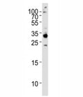 Western blot analysis of HeLa lysate and RPS6 antibody used at 1:1000. Predicted molecular weight ~29 kDa.