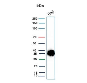 Western blot testing of human Raji cell lysate with CD74 antibody. Expected molecular weight: 33-43 kDa.