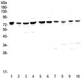 Western blot testing of human 1) HeLa, 2) placenta, 3) COLO-320, 4) HepG2, 5) PANC-1, 6) SGC-7901, 7) MBA-MD-231, 8) rat kidney, 9) mouse heart and 10) mouse kidney with PARN antibody at 0.5ug/ml. Predicted molecular weight ~73 kDa.