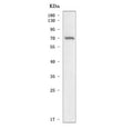 Western blot testing of human RT4 cell lysate with SCNN1A antibody. Predicted molecular weight ~76 kDa.