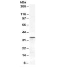 Western blot testing of human heart lysate with VDAC2 antibody at 0.3ug/ml. Predicted molecular weight: ~32kDa.