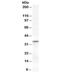 Western blot testing of human heart lysate with VDAC2 antibody at 0.3ug/ml. Predicted molecular weight: ~32kDa.