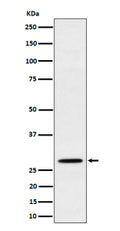Western blot analysis of PSMB10 expression in human Raji cell lysate. Predicted molecular weight ~29 kDa.
