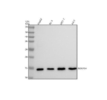 Western blot analysis of NDUFB4 using anti-NDUFB4 antibody. Lane 1: human HepG2 whole cell lysates, Lane 2: human PC-3 whole cell lysates, Lane 3: human MCF-7 whole cell lysates, Lane 4: human whole cell lysates. After electrophoresis, proteins were transferred to a nitrocellulose membrane at 150 mA for 50-90 min. Blocked the membrane with 5% non-fat milk/TBS for 1.5 hour at RT.