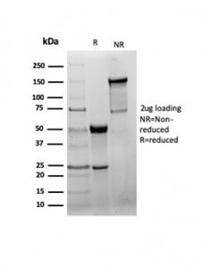 SDS-PAGE analysis of purified, BSA-free GAD2 antibody (clone GAD2/6488R) as confirmation of integrity and purity.