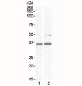 Western blot testing of human 1) kidney and 2) HeLa lysate with PAX8 antibody at 1ug/ml). Predicted molecular weight of isoforms 1-5: 31, 35, 42, 43 and 48 kDa, respectively. PAX-8 can also be observed at ~62 kDa.