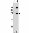 Western blot analysis of DHFR antibody and 293 cell lysate either nontransfected (Lane 1) or transiently transfected (2) with the DHFR gene. Predicted molecular weight ~22 kDa.