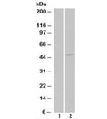 HEK293 overexpressing ILPIP/STRADB (lane 2) tested with STRADB antibody (lane 1-mock transfection). Predicted molecular weight: ~47/31kDa (isoforms alpha/beta).
