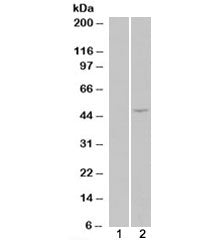 HEK293 overexpressing ILPIP/STRADB (lane 2) tested with STRADB antibody (lane 1-mock transfection). Predicted molecular weight: ~47/31kDa (isoforms alpha/beta).