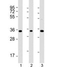 Western blot testing of human 1) K562, 2) THP-1, and 3) HT-1080 cell lysate with TMEM158 antibody at 1:2000. Expected molecular weight: 30-40 kDa.