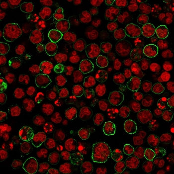 Immunofluorescent staining of human MOLT4 cells with anti-CD20 antibody (green, clone SPM618) and Reddot nuclear stain (red).