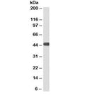 Western blot testing of human heart lysate with ACADM antibody at 3ug/ml. Predicted molecular weight: ~46kDa. An NAP blocker was used in place of non-fat milk as blocking solution and diluent. (1)