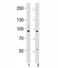 Western blot testing of UHRF1 antibody at 1:4000 dilution; Lane 1: KG-1 lysate, 2: MCF-7 lysate; Predicted/observed molecular weight: ~91/91-106kDa.