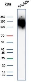 Western blot testing of human spleen tissue lysate with CD45 antibody (clone rPTPRC/1147). Expected molecular weight: 147-220 kDa depending on glycosylation level.