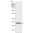 Western blot testing of mouse kidney lysate with Sca-1 antibody. Expected molecular weight: 14-18 kDa.