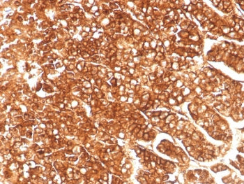 IHC staining of FFPE human adrenal gland tissue with ABCB1 antibody (clone MDR1/8986R). HIER: boil tissue sections in pH 9 10mM Tris with 1mM EDTA for 20 min and allow to cool before testing.