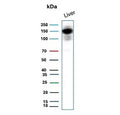Western blot testing of human liver tissue lysate with recombinant Carbamoyl phosphate synthetase 1 antibody. Predicted molecular weight ~165 kDa.