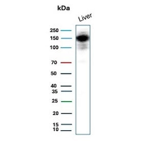 Western blot testing of human liver tissue lysate with recombinant Carbamoyl phosphate synthetase 1 antibody. Predicted molecular weight ~165 kDa.