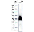 Western blot testing of human lung tissue lysate with Gp36 antibody. Predicted molecular weight ~25 kDa but may be observed at higher molecular weights due to glycosylation.
