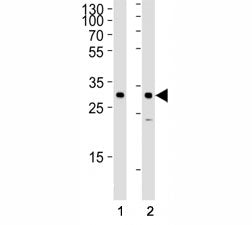 Western blot analysis of lysate from (1) HeLa and (2) SiHa cell line using SNAI1 antibody at 1:1000. Predicted molecular weigth ~29kDa.