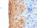 IHC testing of FFPE human tonsil with recombinant Involucrin antibody (clone IVRN/2113R). Staining of formalin-fixed tissues is enhanced by digestion with Trypsin or Protease XXV at 1mg/ml PBS for 5 min at 37oC. Enzyme digestion is more effective than Citrate buffer based epitope unmasking.