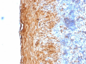 IHC testing of FFPE human tonsil with recombinant Involucrin antibody (clone IVRN/2113R). Staining of formalin-fixed tissues is enhanced by digestion with Trypsin or Protease XXV at 1mg/ml PBS for 5 min at 37oC. Enzyme digestion is more effective than Citrate buffer based epitope unmasking.
