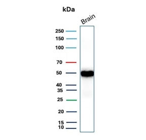 Western blot testing of human brain tissue lysate with recombinant GFAP antibody (clone rGFAP/9150). Predicted molecular weight ~50 kDa.