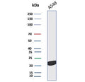 Western blot testing of human A549 cell lysate with Interleukin 18 antibody. Predicted molecular weight ~22 kDa.