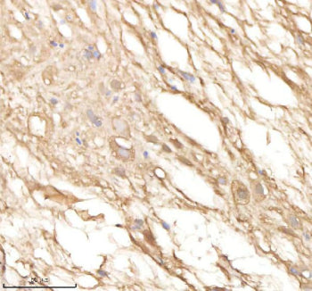 IHC staining of FFPE zebrafish spinal tissue with Psma5 antibody, HRP-labeled secondary and DAB substrate. HIER: boil tissue sections in pH8 EDTA for 20 min and allow to cool before testing.