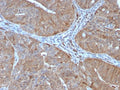 AKR1B1 Antibody Prostate IHC. Immunohistochemistry analysis of FFPE human prostate tissue stained with AKR1B1 Antibody clone CPTC-AKR1B1-2. Strong cytoplasmic HRP-DAB brown staining is observed throughout glandular epithelial cells, consistent with the expected intracellular localization of Aldose reductase / AKR1B1, an oxidative stress-associated metabolic enzyme involved in reactive aldehyde detoxification, glucose-responsive signaling, and cellular redox regulatory pathways.
