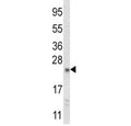 Western blot analysis of NQO2 antibody and mouse liver tissue lysate. Predicted molecular weight ~26 kDa.