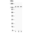 Western blot testing of HIF-1 alpha antibody and Lane 1: human HeLa; 2: human SHG-44; 3: mouse HEPA1-6; Routinely observed molecular weight: 100~120 kDa.