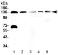 Western blot testing of 1) human 22RV1, 2) human Jurkat, 3) rat pancreas, 4) mouse pancreas and 5) mouse NIH3T3 lysate with NEDD4-2 antibody at 0.5ug/ml. Predicted molecular weight: 112-125 kDa.