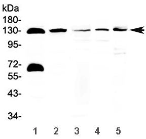 Western blot testing of 1) human 22RV1, 2) human Jurkat, 3) rat pancreas, 4) mouse pancreas and 5) mouse NIH3T3 lysate with NEDD4-2 antibody at 0.5ug/ml. Predicted molecular weight: 112-125 kDa.