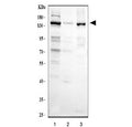 Western blot testing of human 1) HeLa, 2) A431 and 3) SiHa cell lysate with CSB antibody at 0.5ug/ml. Predicted/observed molecular weight: ~168 kDa.