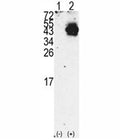 Western blot analysis of PDX1 antibody and 293 cell lysate either nontransfected (Lane 1) or transiently transfected with the PDX1 gene (2). Observed molecular weight 31/40~46kDa (unmodified/modified).