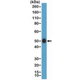 Western blot testing of human placenta lysate with recombinant CD14 antibody at 1:100 dilution. Predicted molecular weight: 40-55 kDa depending on glycosylation level.